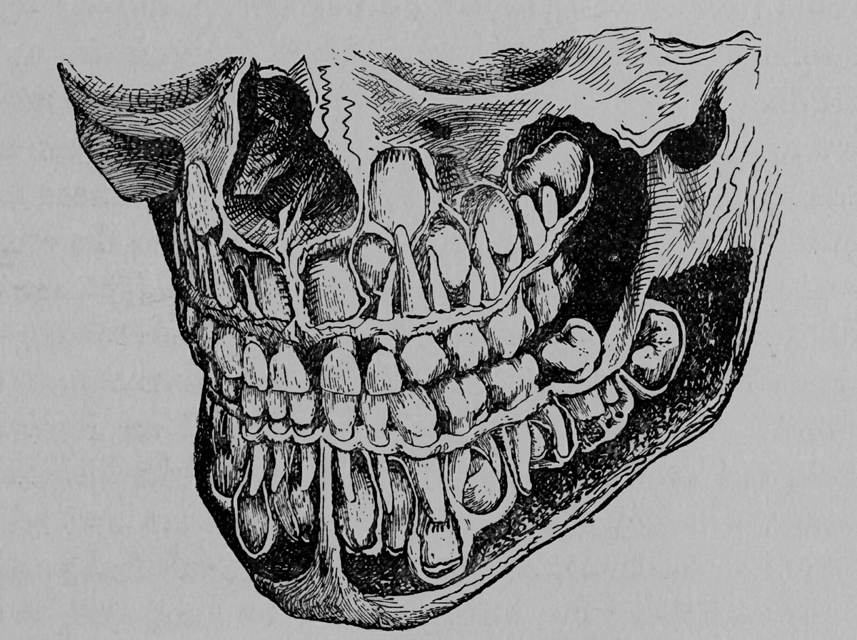 Black-and-white vintage illustration of the skull and tooth roots